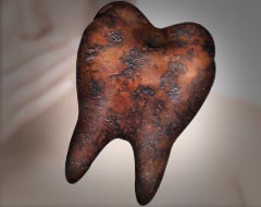 歯周病で汚れた歯のイメージ